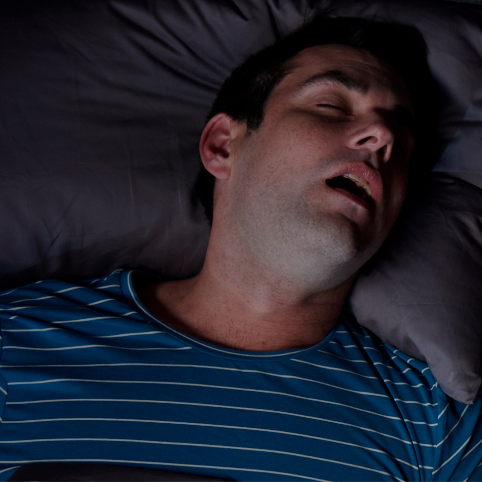 Qué es apnea del sueño?
